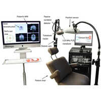 Transcranial Ultrasound Machine