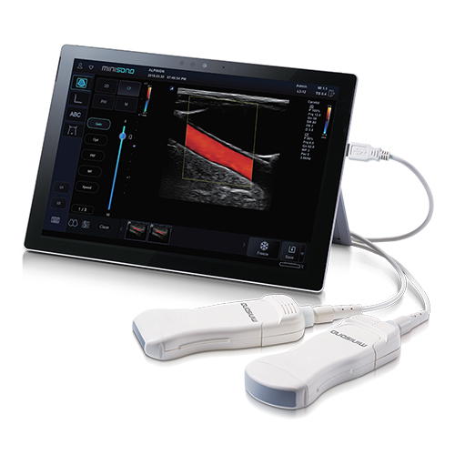Minisono Color Doppler Ultrasound