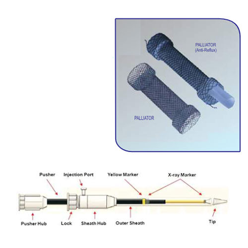 PALLIATOR - ESOPHAGEAL STENT