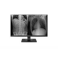 LG 8MP Clinical Review Monitor - Hospital Use, Black Color Design for Enhanced Medical Imaging