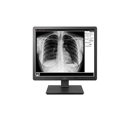 19 (48.26cm) 1.3 MP Clinical Review Monitor 1280 X 1024