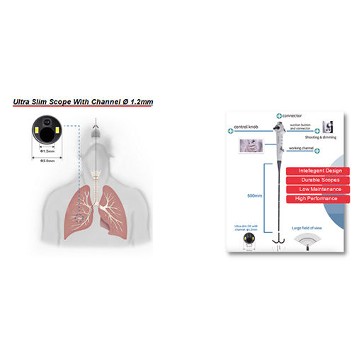 Pulmonology Flexible Digital Bronchoscope