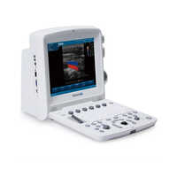 Edan U50 Ultrasound Scanner - High-quality Metal, Portable Design | Manual Operation, Durable Performance For Medical Professionals