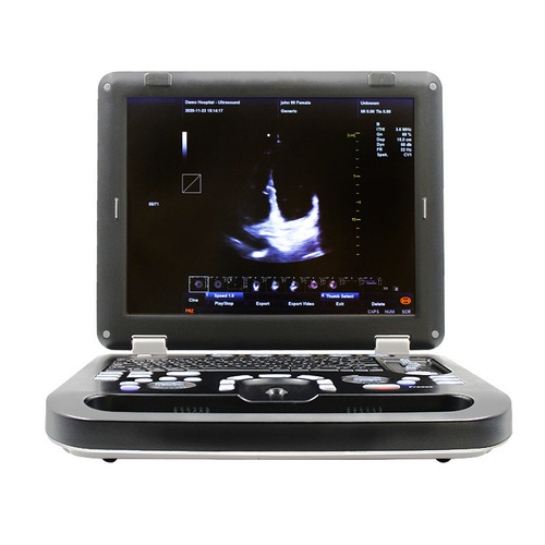 Veterinary color ultrasound machine Veterinary B-ultrasound diagnostic equipment