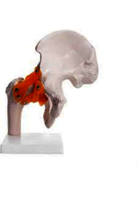 Life Size Hip Joint Models