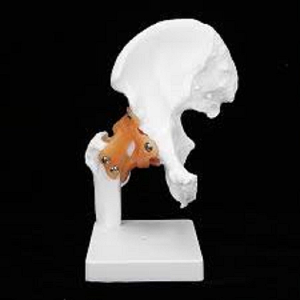 Life Size Hip Joint Models