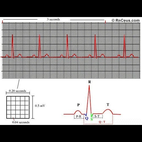 Ecg Paper Hd - Color: Black