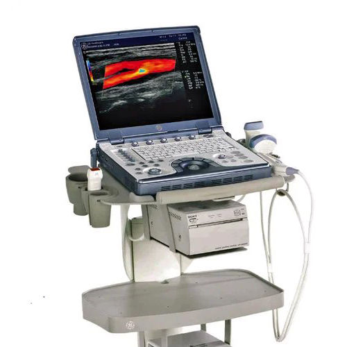 Ge Vivid E Ultrasound Machine