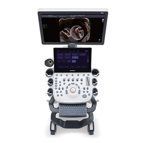 P20 Trolley Color Doppler Ultrasound Machine