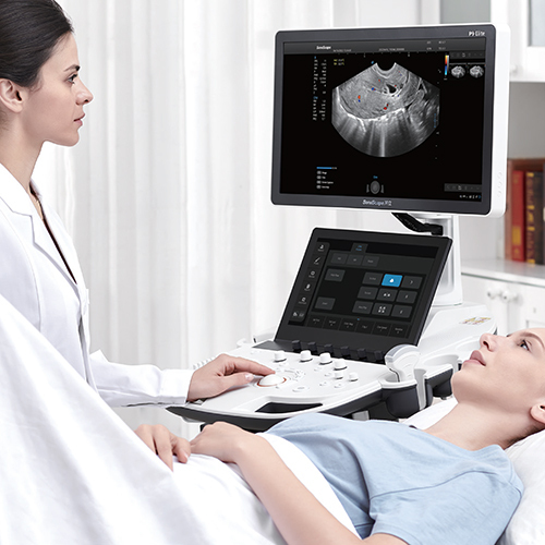 P9 Elite Sonoscape Trolley Ultrasound Machine