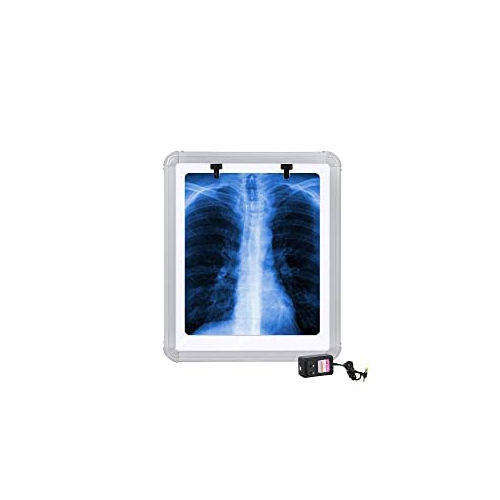 White Led X-Ray View Box With Automatic Film