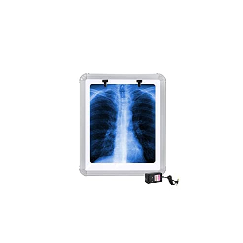 LED X-Ray View Box with Automatic Film