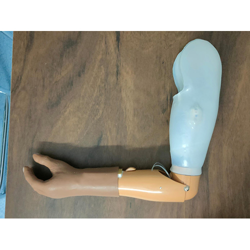 Myoelectric Electric Hand Above Elbow