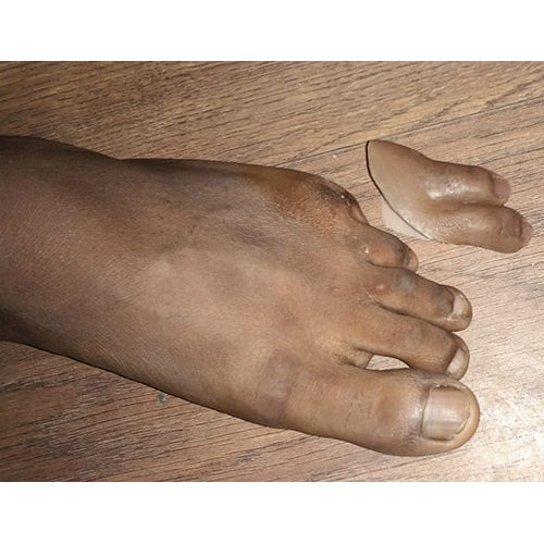 Human Silicone Foot