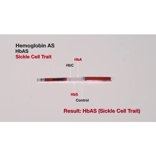 Hemotype Sc Rapid Test Kit