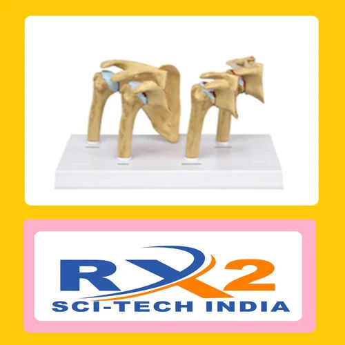 Stages Ostearthritis Shoulder Model For Medical Student