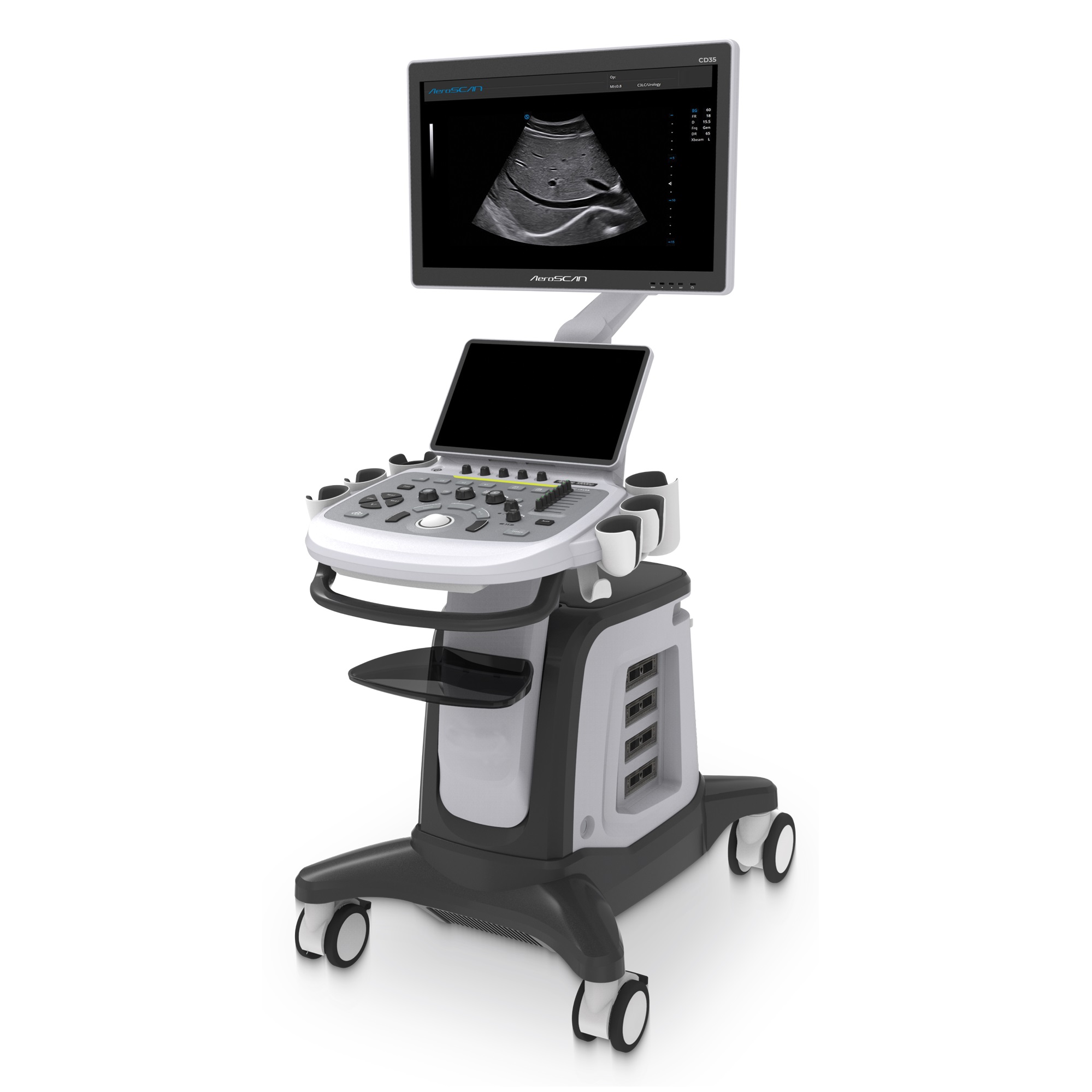 Aeroscan CD35 - Colour Doppler Ultrasound Machine