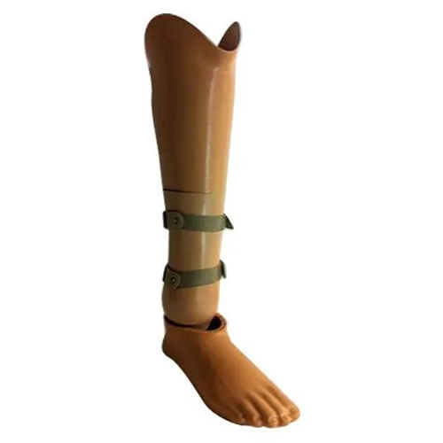 Symes Prosthesis