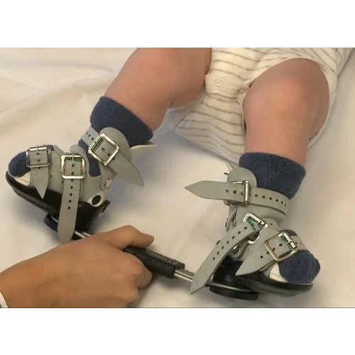 Pvc Db Splint For Club Foot - Attributes: Waterproof