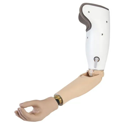 Upper Limb Prosthesis