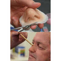 Silicone Nose Prosthesis