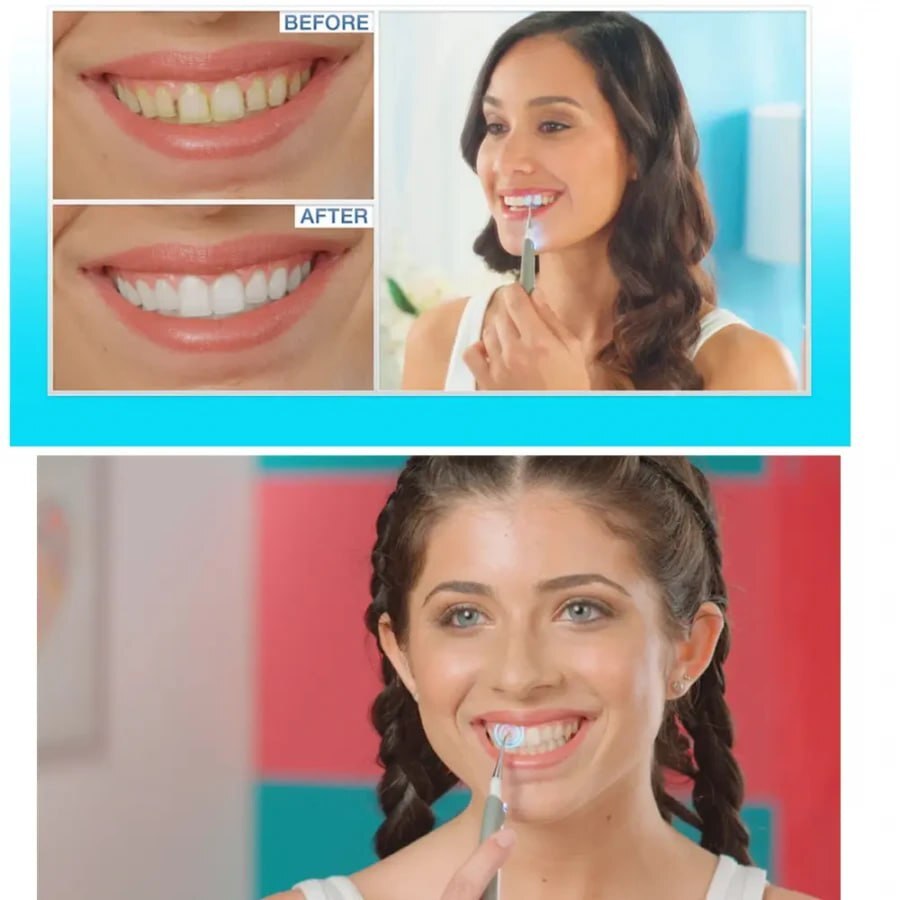 ULTRASONIC ELECTRIC TOOTH DENTAL CLEANER WITH LED LIGHT