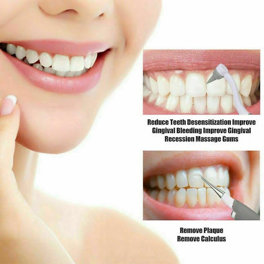 ULTRASONIC ELECTRIC TOOTH DENTAL CLEANER WITH LED LIGHT