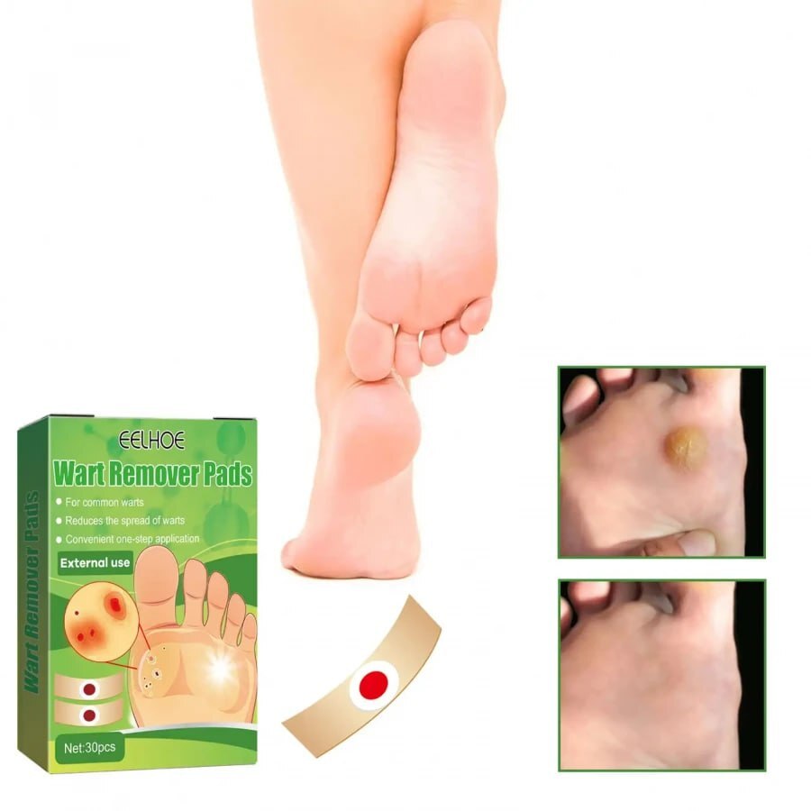 1 PC FOOT CORN REMOVER PADS