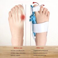 HALLUX VALGUS CORRECTOR 12738