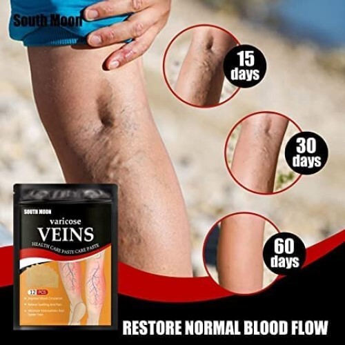 SINAGAR aricose Veins Patches Dredge Vein Smoothing Varicose Veins Reduce Swelling Relieve Pain Instant Relief from Muscular Pain & Joint Pain Natural Pain Relief Patches Improve, Blood Circulation