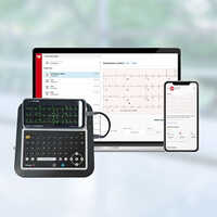 Tricog AI Based ECG Machine