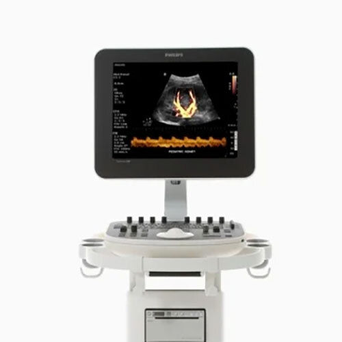 Refurbished Philips ClearVue 550 Ultrasound Machine