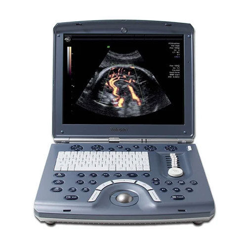 GE Voluson e Ultrasound (Refurbished)