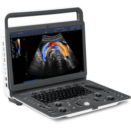 Sonoscape E2 Color Doppler