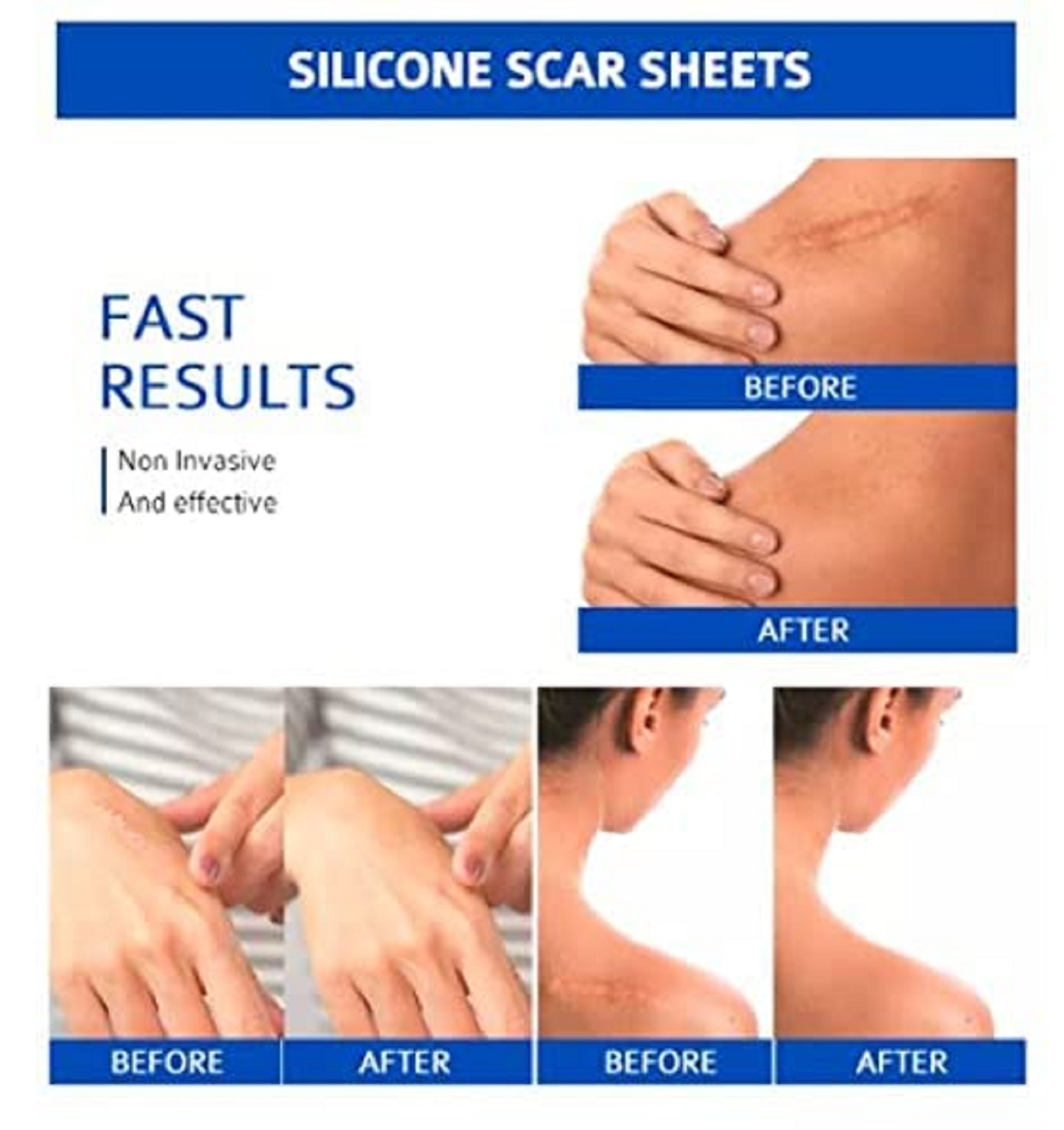 SILICONE GEL STRIPS PATCH