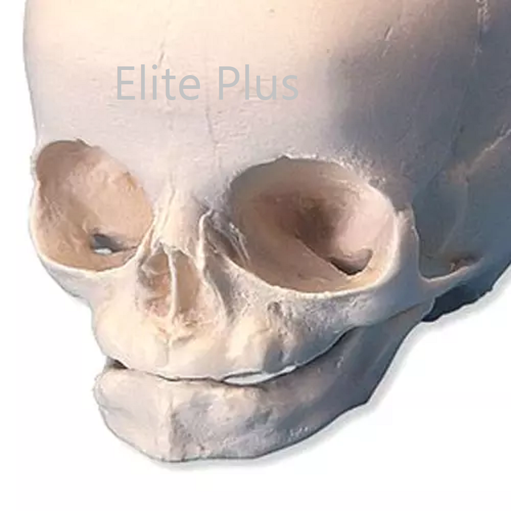 ZX-1201 Human Fetal Skull