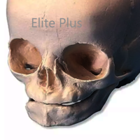 ZX-1201 Human Fetal Skull