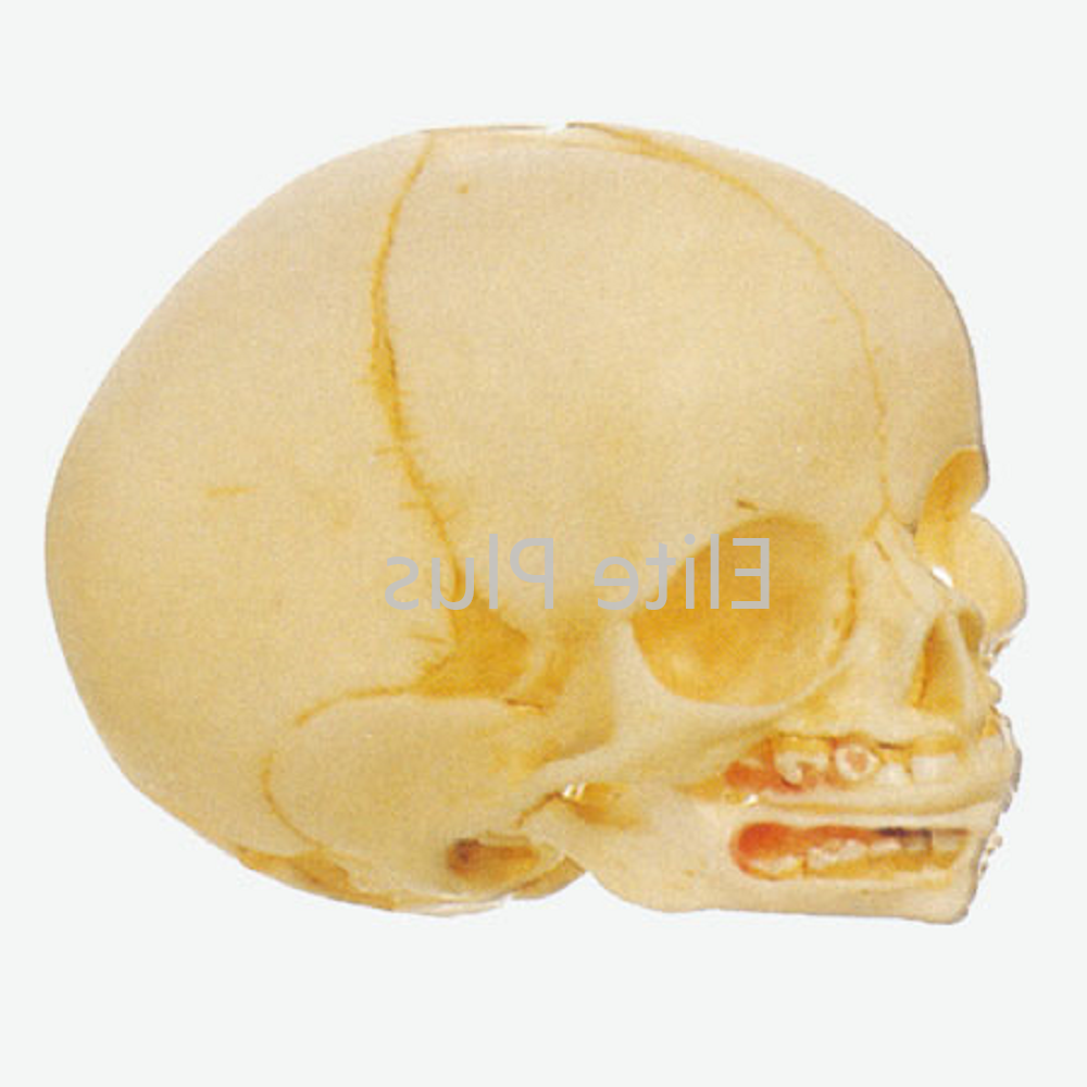 GD/A11115 Infant Skull