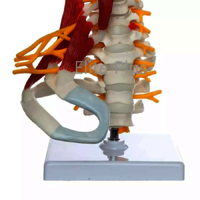 ZX-1228 Cervical Spine & Occipital Bone, Nerves and Muscles