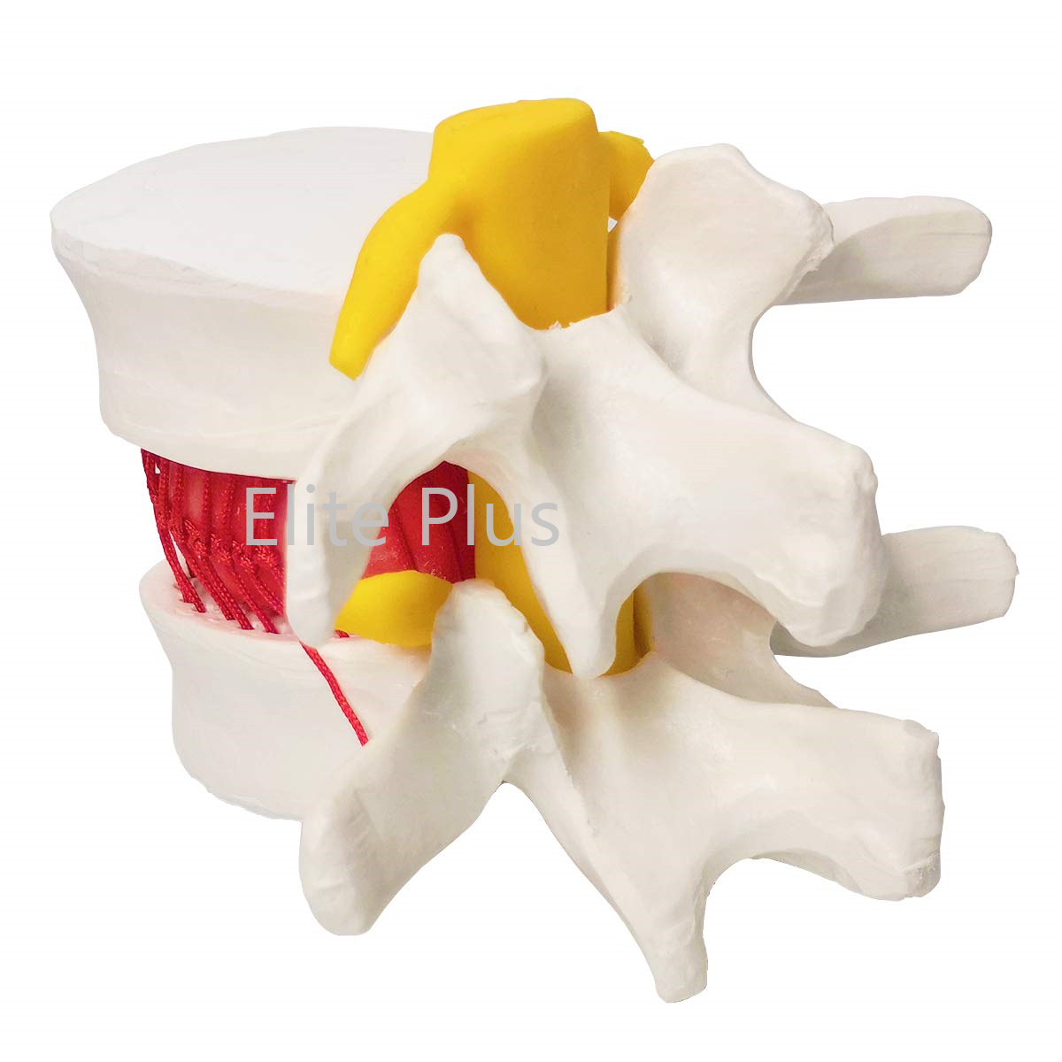 ZX-1504 Functioning Prolapsed Lumbar Vertebrae Model