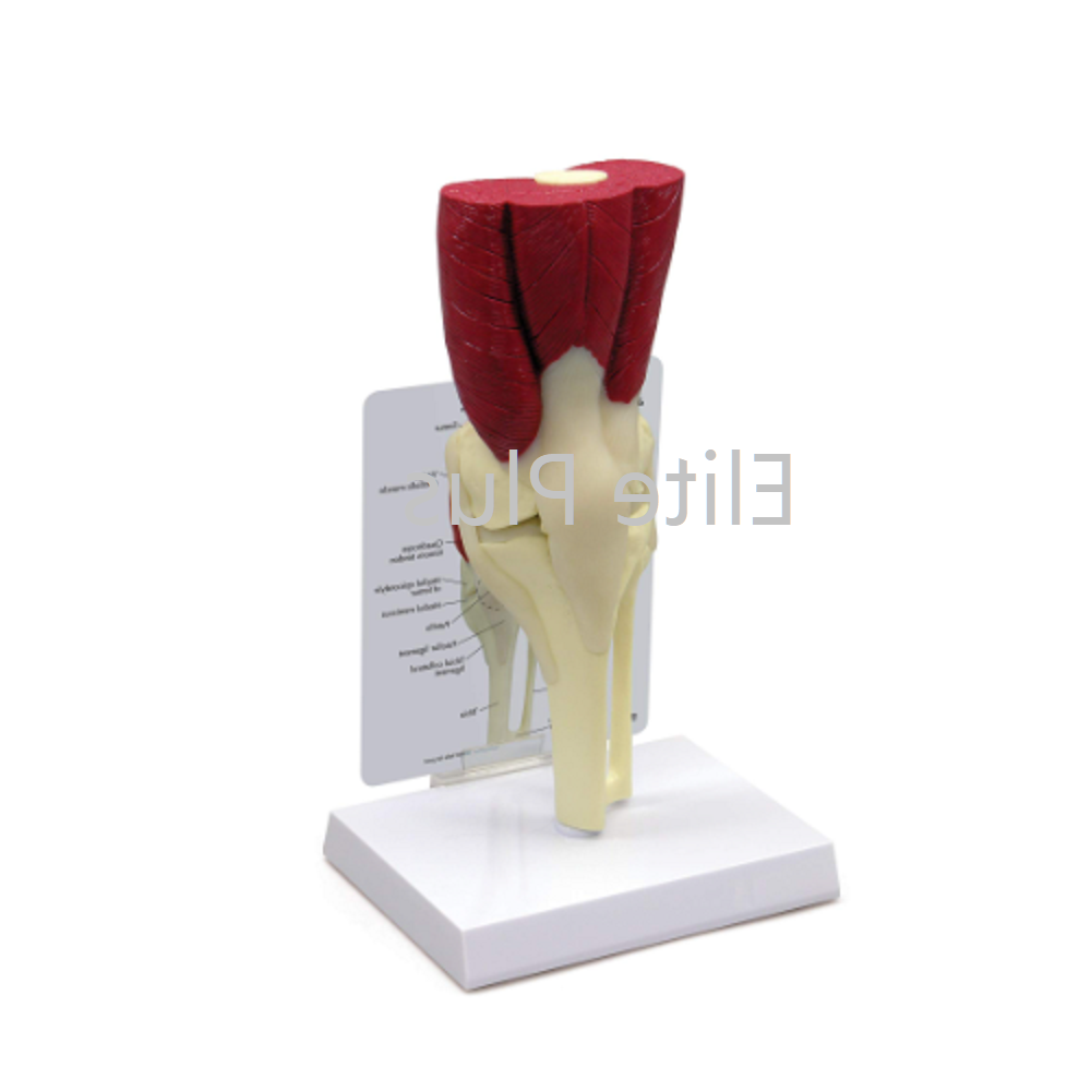 ZX-1226A Knee Joint Model Deluxe with Muscles & Ligaments