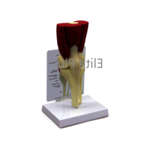 ZX-1226A Knee Joint Model Deluxe with Muscles & Ligaments