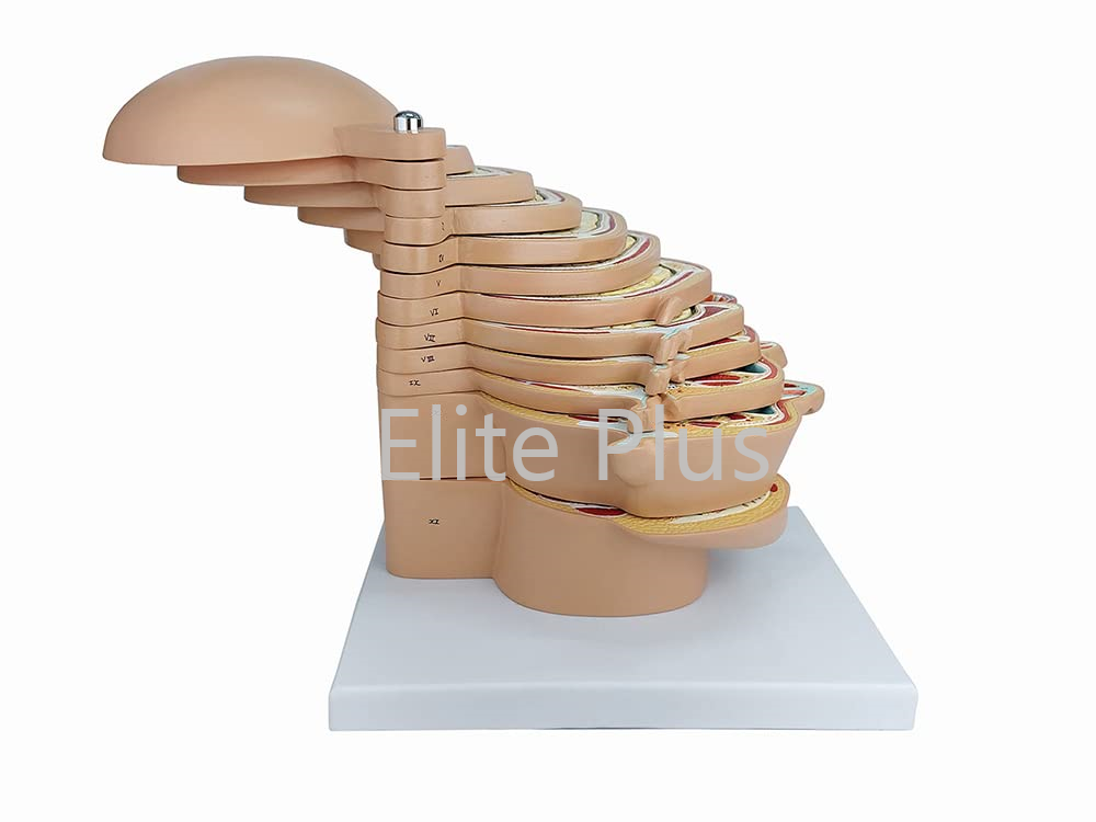 ZX-1433PN Sliced Head Model, 12 Slices