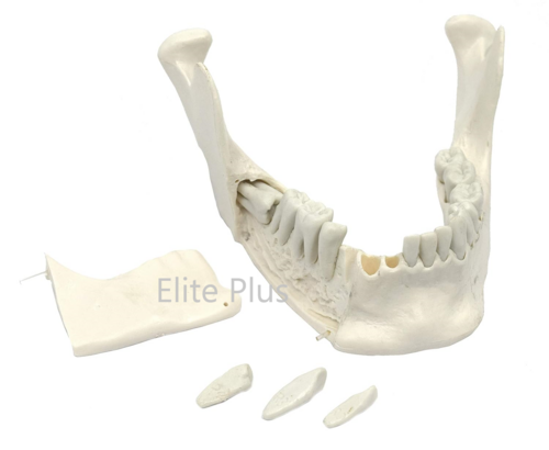 ZX-1230 Lower Jaw Model with Extractable Teeth