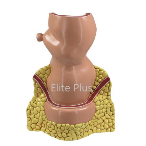 ZX-1514P Rectum Pathologies Model