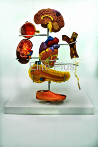 Zx-1511p Diabetes Mellitus Complications Model - Color: Multicolor