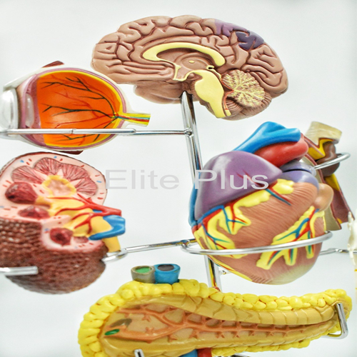 ZX-1511P Diabetes Mellitus Complications Model