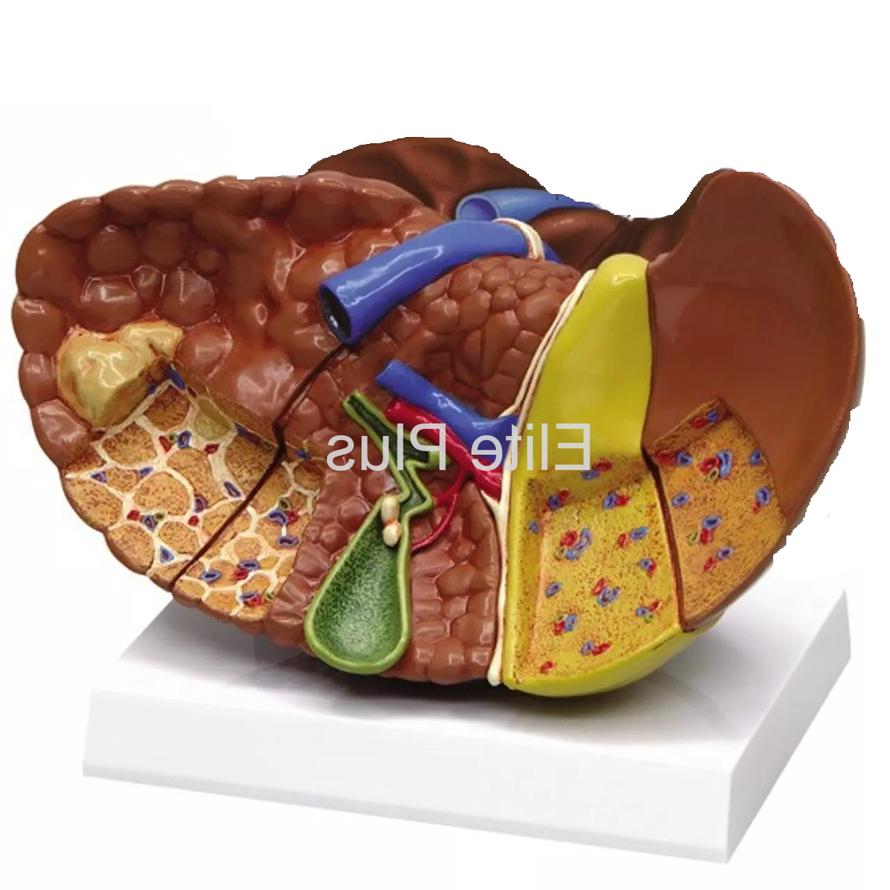 ZX-1430 Liver (Healthy & Pathologies)