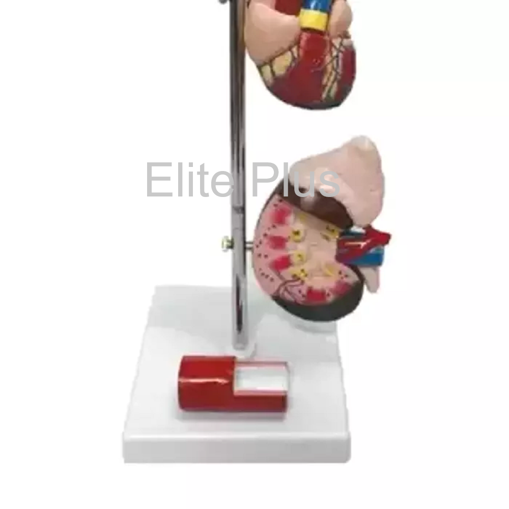 ZX-1509P Hypertension Model