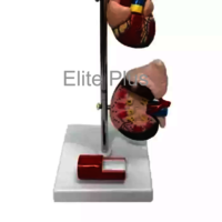 ZX-1509P Hypertension Model